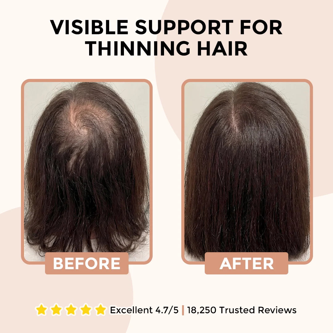 ATHENA™ - Root Revival Shampoo - Increased Hair Growth with Just 4 Washes a Week*
